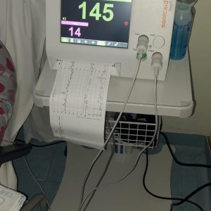Monitoraggio fetale: 11 nuovi cardiotocografi nella nostra Asl