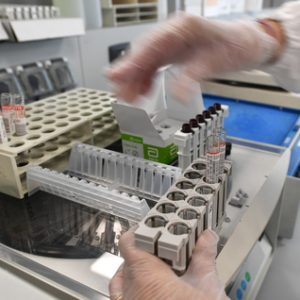 Test rapido per il Coronavirus, arrivano in Puglia 2800 kit