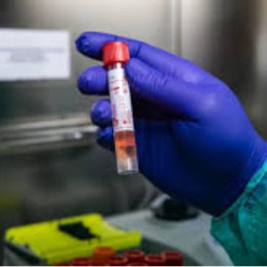 Coronavirus: nuovo aumento di contagi in Puglia, oggi 69